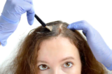 How to Find the Best Non-Surgical Hair Loss Treatment New Jersey Offers?
