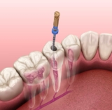 Trinity Dental @ Alkimos Will Handle Your Dental Needs