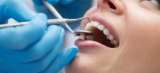 Smile Confidently Again: Benefits Of Single-Tooth Dental Implants